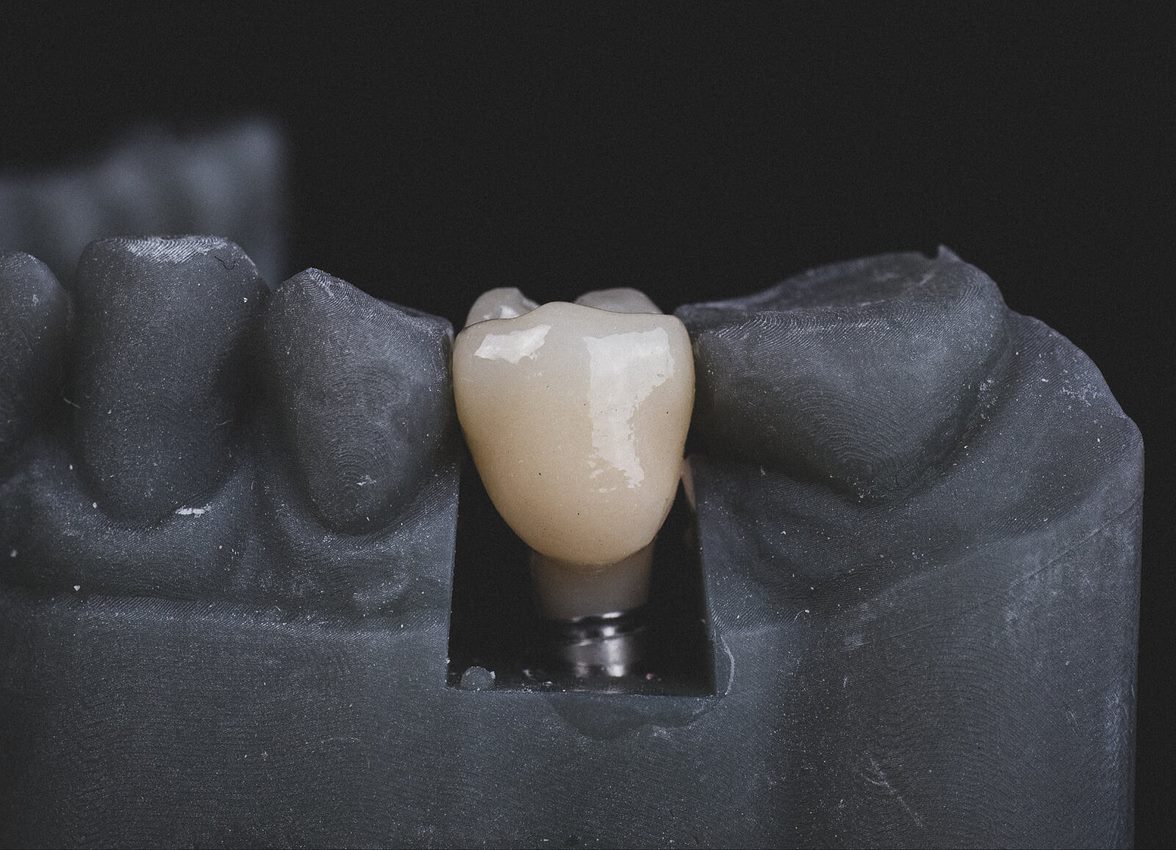 Enhancing Dental Education: The Role of Haptic Feedback in Preclinical Training
